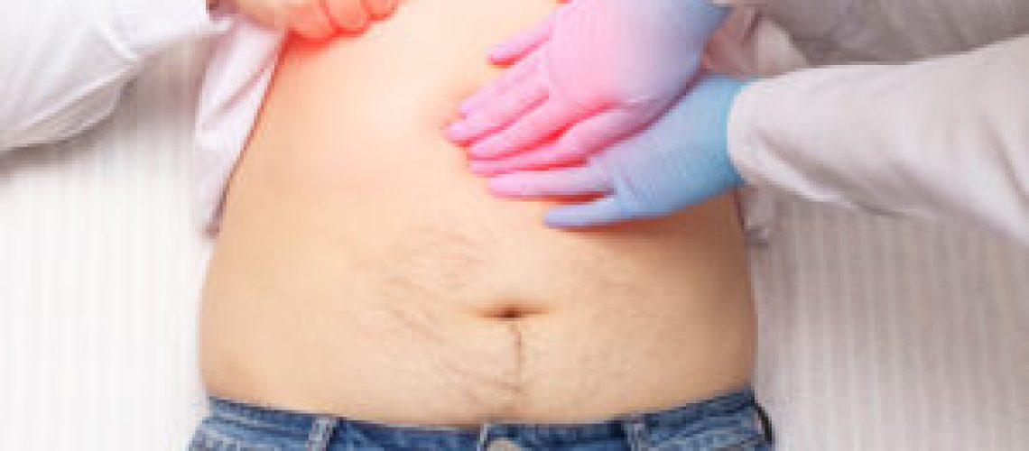 The doctor examines a patient who has abdominal pain. Pancreas inflammation concept, pancreatitis, close-up. Inflammation of the gallbladder and duodenum